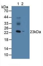 NME5 Antibody in Western Blot (WB)