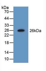 NME5 Antibody in Western Blot (WB)