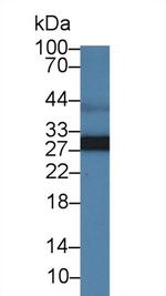 Adiponectin Polyclonal Antibody
