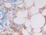HLA-DRB1 Antibody in Immunohistochemistry (Paraffin) (IHC (P))