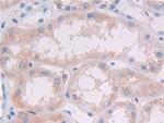 HLA-DRB1 Antibody in Immunohistochemistry (Paraffin) (IHC (P))