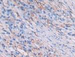 HLA-DRB1 Antibody in Immunohistochemistry (Paraffin) (IHC (P))