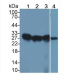 HLA-DRB1 Antibody in Western Blot (WB)