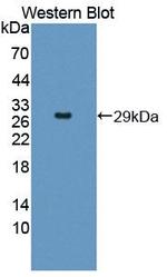 EPSTI1 Antibody in Western Blot (WB)
