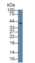 ABHD7 Polyclonal Antibody