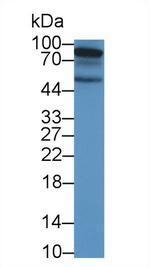 EphA10 Antibody in Western Blot (WB)