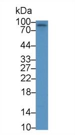 EphA10 Antibody in Western Blot (WB)