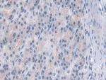 PDE4B Polyclonal Antibody