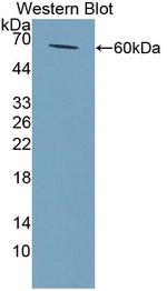 NAT2 Antibody in Western Blot (WB)