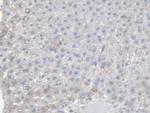 CES1 Antibody in Immunohistochemistry (Paraffin) (IHC (P))