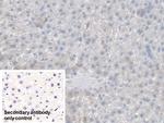 CES1 Polyclonal Antibody