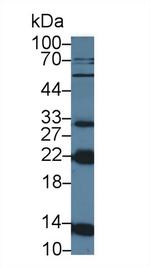 NUTF2 Antibody in Western Blot (WB)