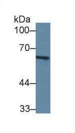 C8A Antibody in Western Blot (WB)