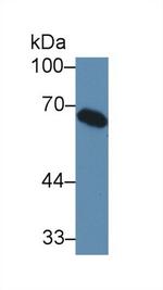 C8A Antibody in Western Blot (WB)