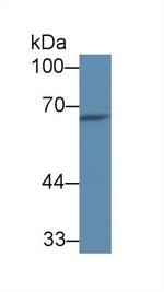 C8A Antibody in Western Blot (WB)