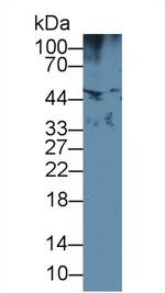 HFE2 Antibody in Western Blot (WB)