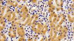 CPPED1 Antibody in Immunohistochemistry (Paraffin) (IHC (P))