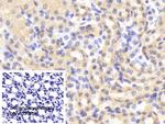 MMP1 Antibody in Immunohistochemistry (Paraffin) (IHC (P))