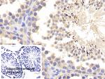 MMP1 Antibody in Immunohistochemistry (Paraffin) (IHC (P))