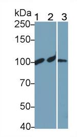 Complement C4a Antibody in Western Blot (WB)