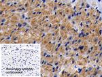 Prohibitin Polyclonal Antibody