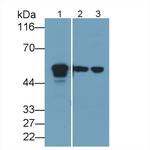 Acid Phosphatase 2 Antibody in Western Blot (WB)