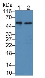 GBA Polyclonal Antibody