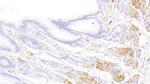Tryptase Antibody in Immunohistochemistry (Paraffin) (IHC (P))