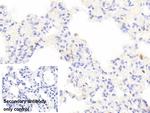 Tryptase Antibody in Immunohistochemistry (Paraffin) (IHC (P))