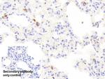 Tryptase Antibody in Immunohistochemistry (Paraffin) (IHC (P))