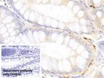 Tryptase Antibody in Immunohistochemistry (Paraffin) (IHC (P))