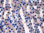 LAD1 Antibody in Immunohistochemistry (Paraffin) (IHC (P))