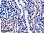 LAD1 Polyclonal Antibody