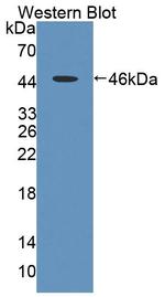 LAD1 Antibody in Western Blot (WB)