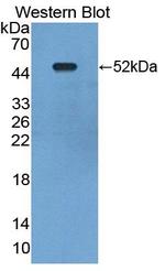 Synphilin 1 Antibody in Western Blot (WB)