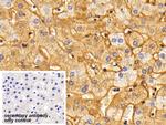 Fibrinogen Antibody in Immunohistochemistry (Paraffin) (IHC (P))