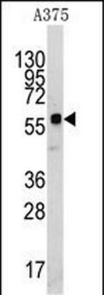 KREMEN1 Polyclonal Antibody