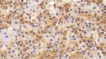TSH beta Antibody in Immunohistochemistry (Paraffin) (IHC (P))