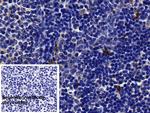 Tryptase Polyclonal Antibody