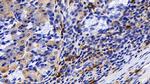 Tryptase Antibody in Immunohistochemistry (Paraffin) (IHC (P))