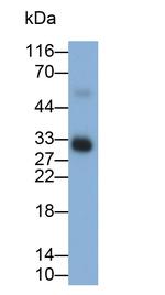 Tryptase Antibody in Western Blot (WB)