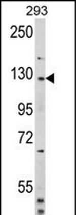 DAAM2 Antibody in Western Blot (WB)
