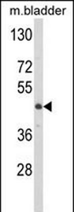 LUM Antibody in Western Blot (WB)