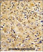 LUM Polyclonal Antibody