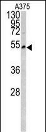 LUM Antibody in Western Blot (WB)
