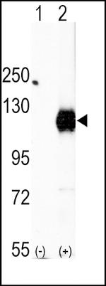 EphA2 Polyclonal Antibody
