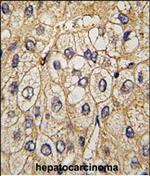 EphA7 Polyclonal Antibody