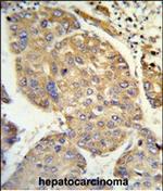 PHACTR2 Polyclonal Antibody