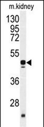 POLDIP2 Antibody in Western Blot (WB)