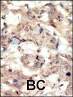 EphB6 Polyclonal Antibody